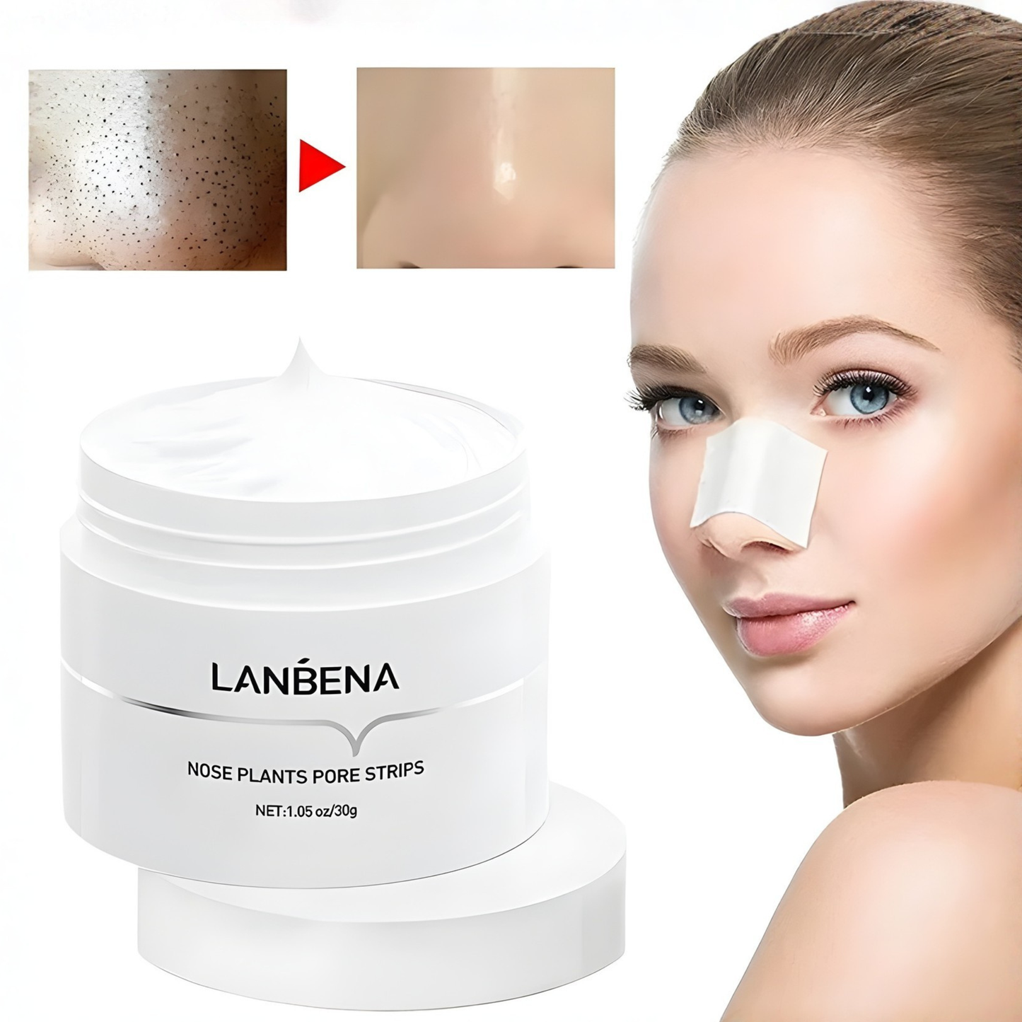 Crema removedora de puntos negros de la nariz